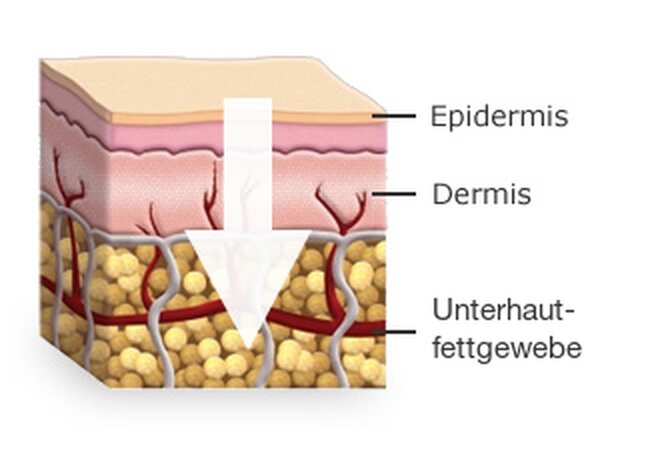So wirken transdermale Cremes